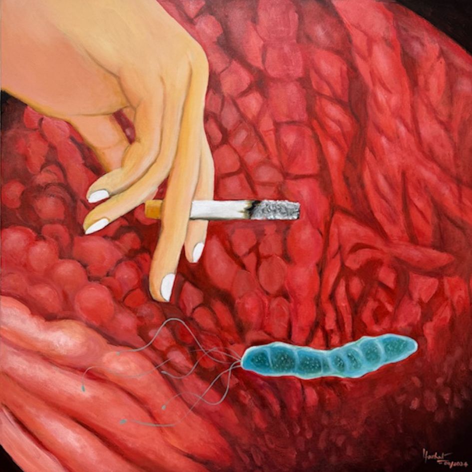 Helicobacter Pylori (H. Pylori) and smoking